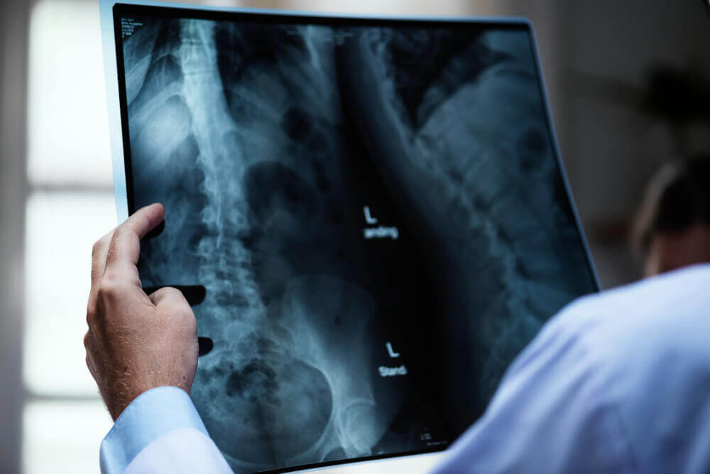 Radiology - Hill Candy Hospital